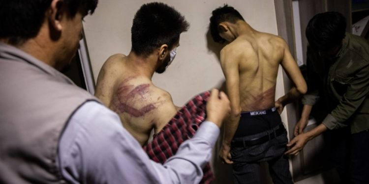 Two Afghan journalists who were beaten by Taliban members. Photo Credit: The New York Times